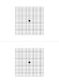 Graella d'Amsler per imprimir. Situar-la a 33 cm i, amb cada ull, mirar al punt central.