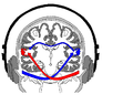 Figur 1 Høyre øret sine auditive baner (rød farge) har direkte tilgang til den venstre språkdominante hemisfæren. Venstre øret sine auditive baner (blå farge) må derimot krysse hjernebjelken for at lyden skal registreres [3]