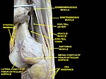 Muscles of thigh. Lateral view.