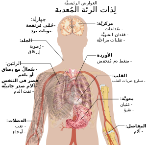 رسم تخطيطي لجسم الإنسان يحدد الأعراض الرئيسية لذات الرئة
