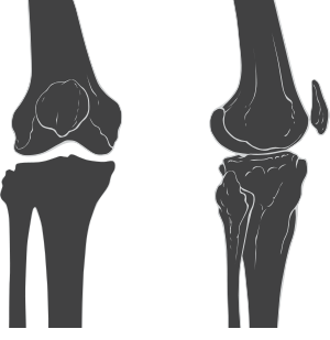 Knee skeleton diagram