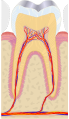 Zahn im Knochen des Alveolarfortsatzes verankert