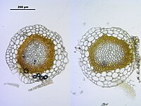 Obraz mikroskopowy, dwa okrągłe brązowozielone przekroje poprzeczne łodyżki na jasnym tle