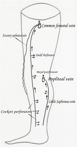 Akcesora saphenoza vein2.png