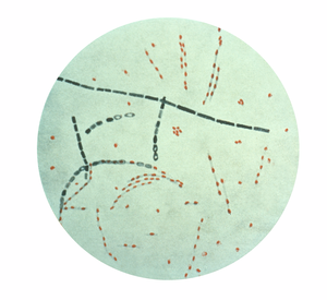 Photomicrograph of Bacillus anthracis from an ...