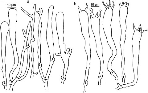 A - leptocystydy, B - podstawki