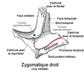 Os zygomatique avec l'insertion du masséter.
