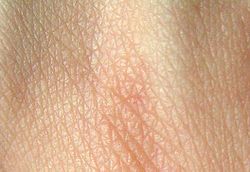 Human skin structure.jpg