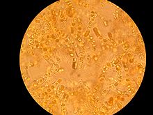 The photosynthetic cyanobacterium Hyella caespitosa (round shapes) with fungal hyphae (translucent threads) in the lichen Pyrenocollema halodytes Hyella caespitosa.jpg