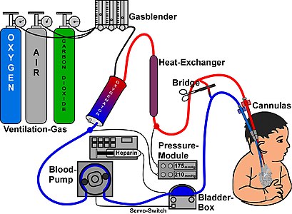 Esquema d'un equip d'ECMO