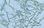 Thumbnail for Cyanobacteria
