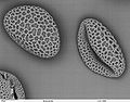 Pollen of Lilium auratum (Oriental Lily) Back-scattered electron microscope image