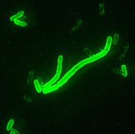 Yersinia pestis seen at 2000x