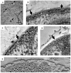 Crateriform structures. (A) Crateriform structures from the outside of the cell (B-E) Micrographs of crateriform structures, perpendicular to the membrane outer membrane (OM), inner membrane (IM), cytoplasm (C), and periplasm (P). Scale bars, 50 nm Crateriform.png