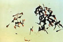 Clostridium tetani.jpg