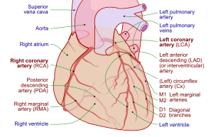 Basic illustration of positioning of aorta, pu...