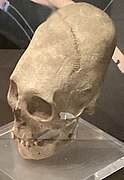 Elongated skull, female, post-Roman period