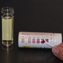 A test strip is compared with a colour chart that indicates the degree of ketonuria.