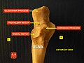 الثلمة الهلالية (بالإنجليزية: Trochlear notch)‏ في وسط الصورة.