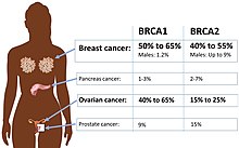 BRCA1 and BRCA2 mutations and absolute cancer risk BRCA1 and BRCA2 mutations and absolute cancer risk.jpg