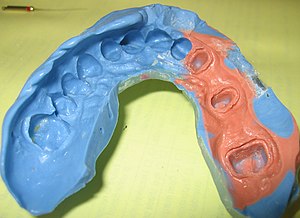 dental imprint