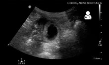 File:UOTW 40 - Ultrasound of the Week 1.webm