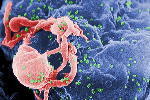 Scanning electron micrograph of HIV-1 (in green) budding from cultured lymphocyte. Multiple round bumps on cell surface exist sites of assembly together with budding of virions.