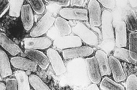 Eletromicrografia de Rhabdovírus causadores da estomatite vesicular.