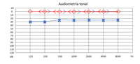 Miniatura para Audiograma