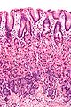 Gastric mucous membrane