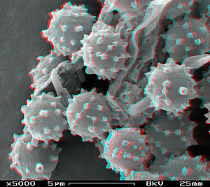Споры клубочков в стереоскопическом сканирующем электронном микроскопе, увеличение 5000x.JPG