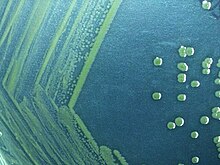Грамотрицательные бактерии Shigella sonnei, культивированные в течение 48 часов на кишечном агаре Hektoen.jpg