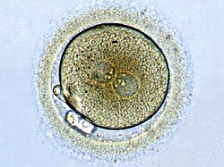 Zygote