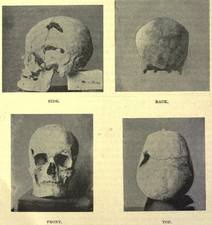 Vermoedelijke schedel van Sanacht