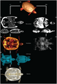 CT and MRI of a red-eared slider (Trachemys scripta). Source: Lauridsen, Henrik; Hansen, Kasper; Wang, Tobias; Agger, Peter; Andersen, Jonas L.; Knudsen, Peter S.; Rasmussen, Anne S.; Uhrenholt, Lars; Pedersen, Michael (2011). "Inside Out: Modern Imaging Techniques to Reveal Animal Anatomy". PLoS ONE. 6 (3): e17879. doi:10.1371/journal.pone.0017879. PMID 21445356.{{cite journal}}: CS1 maint: unflagged free DOI (link).