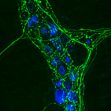 Міентериальний ганглій миші з тирозингідроксилазою (позначає симпатичні вегетативні аксони), позначений імуногістохімічним методом (зелений), отриманий за допомогою лазерного скануючого конфокального мікроскопа. Синій колір – це аутофлуоресценція в УФ-діапазоні постгангліонарних нейронів.