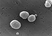 Streptococcus pneumoniae bakterisi, zatürrenin yaygın nedenlerinden biridir.