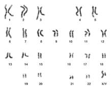 Micrographic karyogram of a human male. See section text for details. DNA human male chromosomes.gif