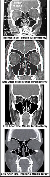 File:Samples-of-ENS-CT's.jpg