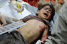 Injured child, 17 October 2023 Fars Photo of Casualties in Gaza Strip during 2023 War 31.jpg