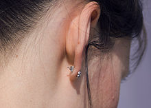 Healed pierced earlobe with a stud earring GirlWithEarring.jpg