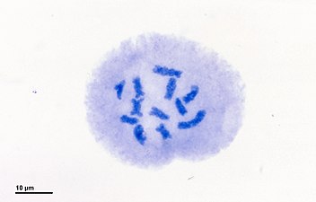 Cromosomes en la fase diacinesi