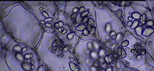 Leucoplasts Potato storage tissue containing amyloplasts. (Leucoplast).jpg