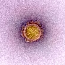 Novel Coronavirus SARS-CoV-2 (49597768447).jpg