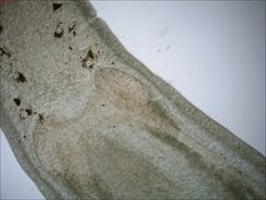 Brain and neural cords of hoplonemertean Amphiporus ochraceus. Several clusters of dark eyespots and the opening of one cerebral organ are also visible. Amphiporus ochraceus brain.jpg