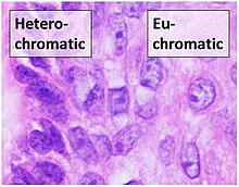 Microscopy of heterochromatic versus euchromatic nuclei (H&E stain). Heterochromatic versus euchromatic nuclei.jpg