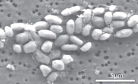 Células da bactéria GFAJ-1 cultivadas em arsénio.