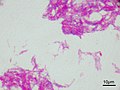 Vignette pour Mycobacterium tuberculosis var. bovis