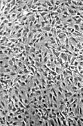 Normale NIH-3T3-Zellen in einer Zellkultur, Phasenkontrastmikroskop 100× Vergrößerung