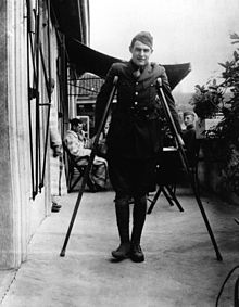 young man on crutches